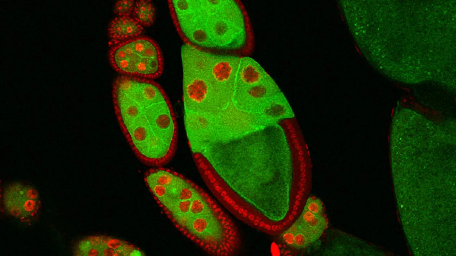 Fungi under the microscope